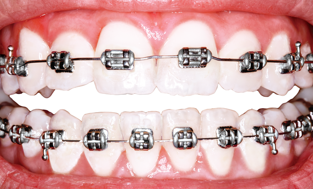 orthodontics