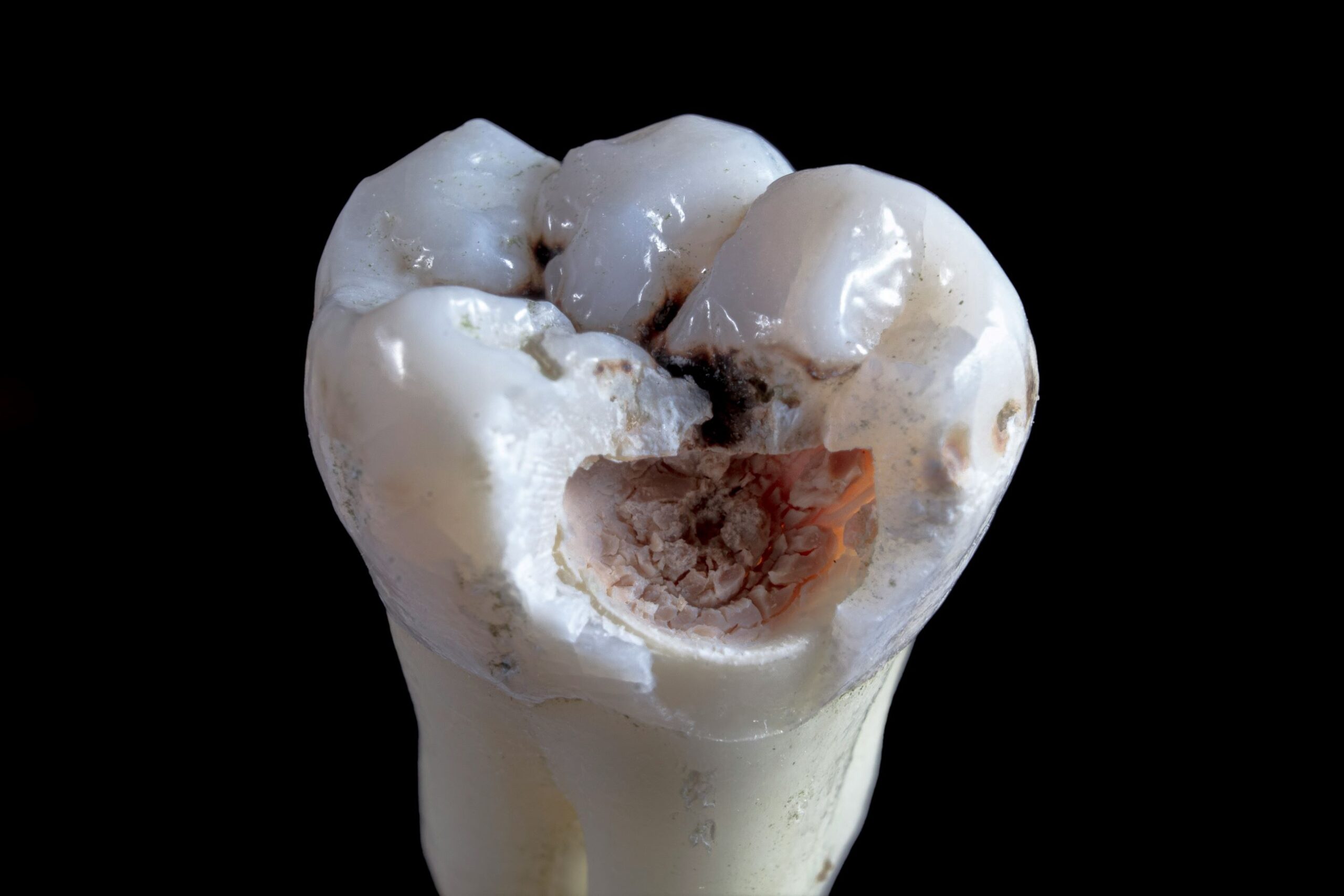 dental injury