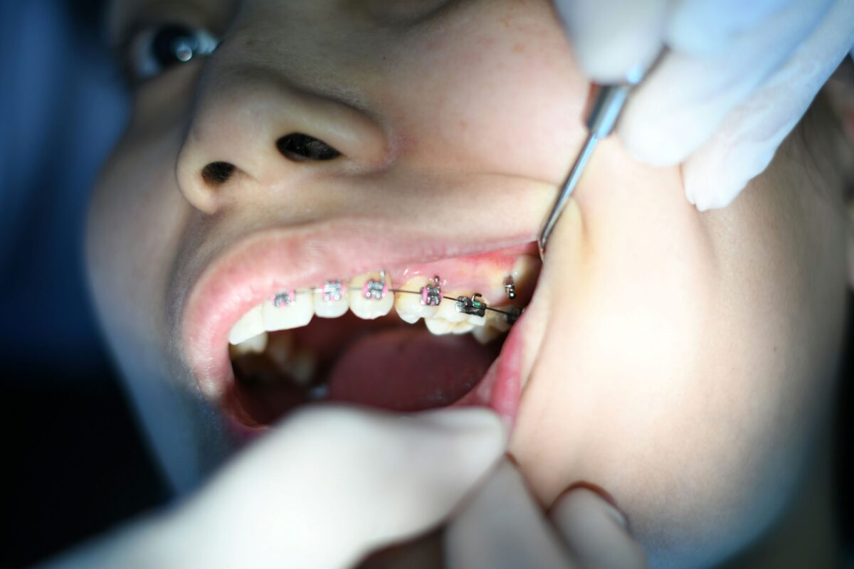 Dental Electives in Kenya