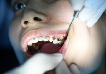 Dental Electives in Kenya